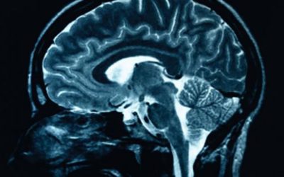 How Trauma Rewires the Brain